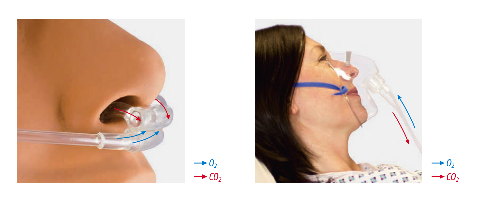 Dual Nasenkanülen und Masken